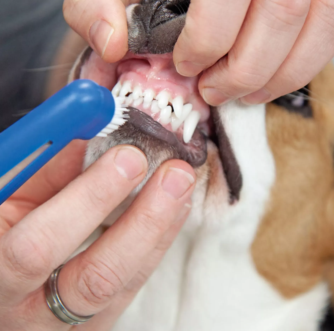 Finger-Zahnbürsten-Set